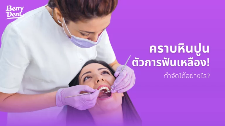 คราบหินปูน ตัวการฟันเหลือง กลิ่นปาก! กำจัดได้อย่างไร?