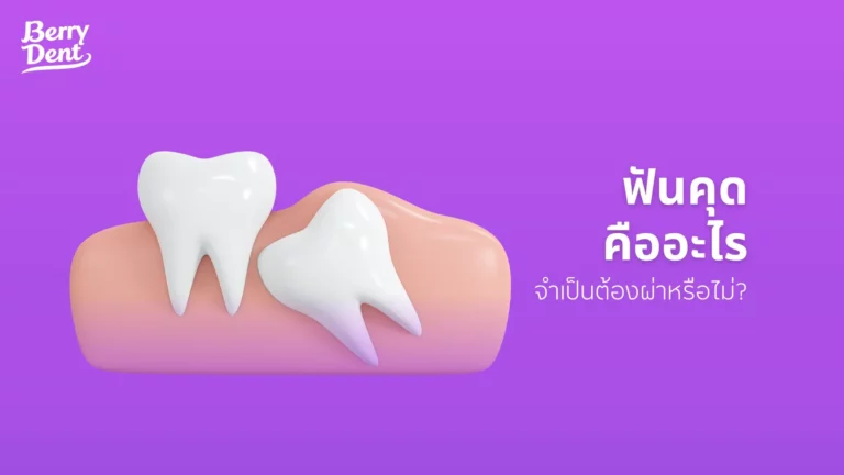 ฟันคุดคืออะไร จำเป็นต้องผ่าหรือไม่