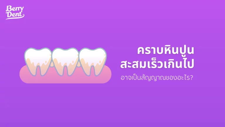 คราบหินปูนสะสมเร็วเกินไป อาจเป็นสัญญาณของอะไร?