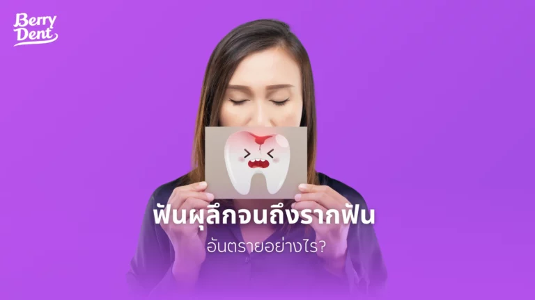 ฟันผุลึกจนถึงรากฟัน อันตรายอย่างไร?