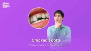 Cracked Tooth Causes, Risks & Treatment