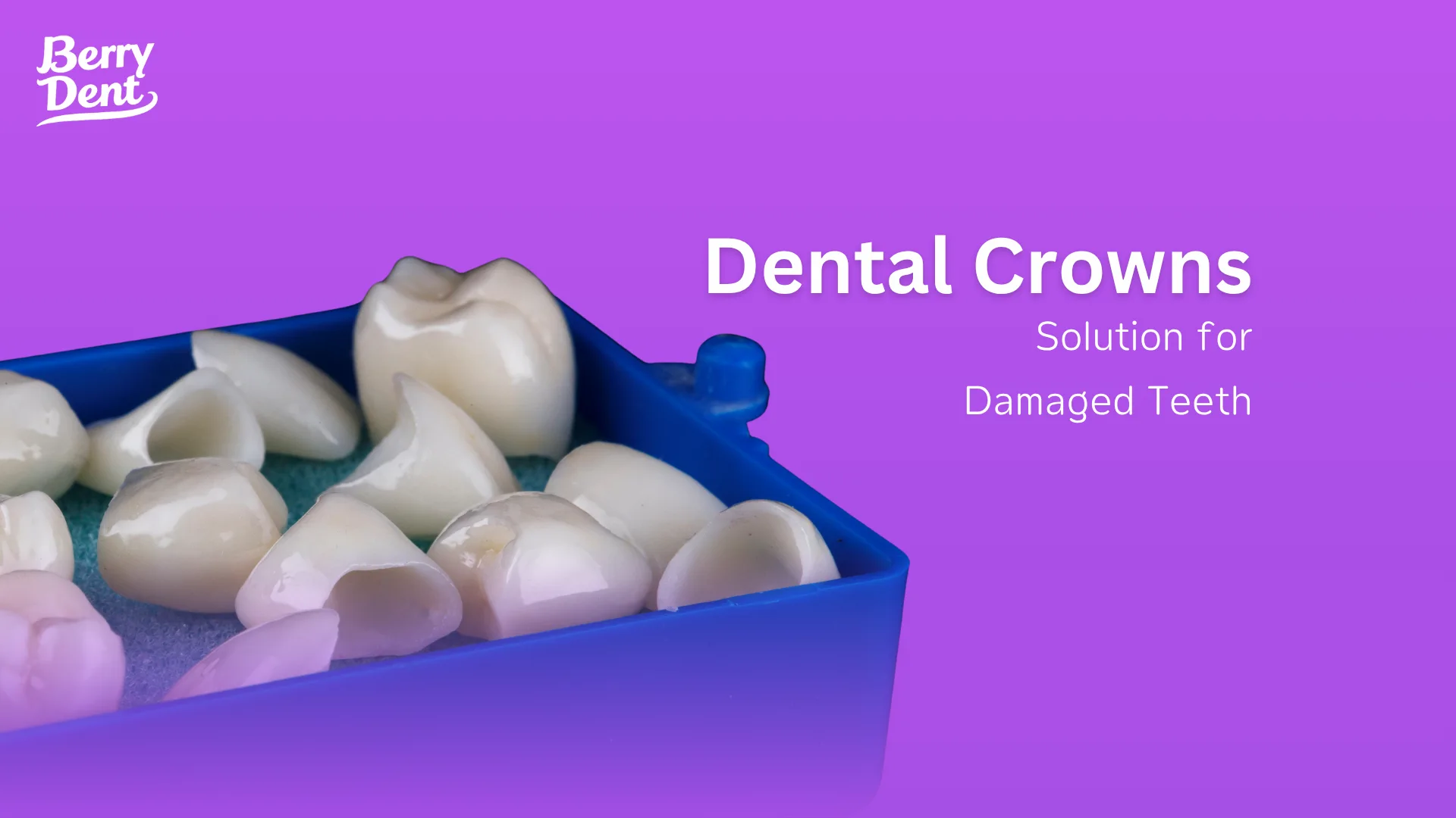 Dental Crowns: Solution for Damaged Teeth