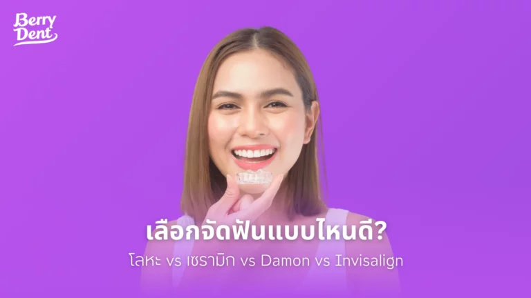 จัดฟันแบบไหนดี? เปรียบเทียบชัดๆ จัดฟันโลหะ vs เซรามิก vs Damon vs Invisalign