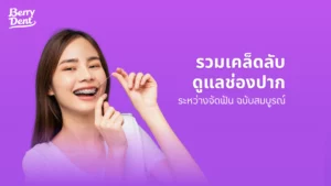 รวมเคล็ดลับดูแลช่องปากระหว่างจัดฟัน ฉบับสมบูรณ์